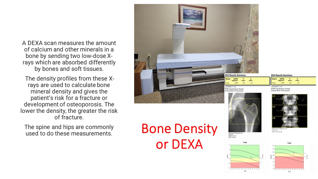 bone density explained