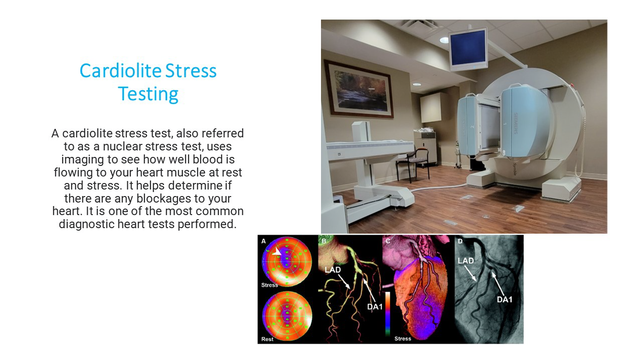 Cardiolite explained