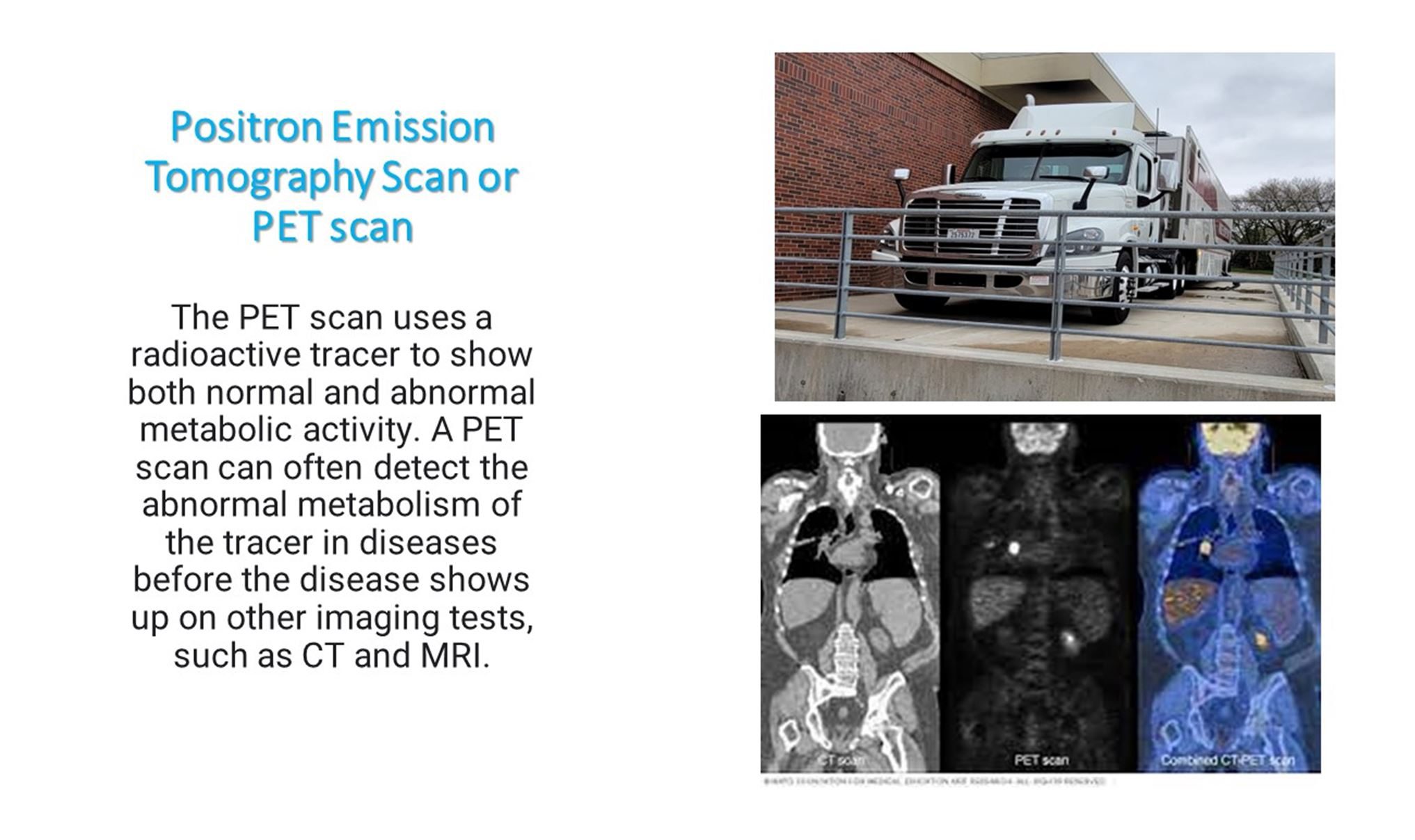 PET scan explained