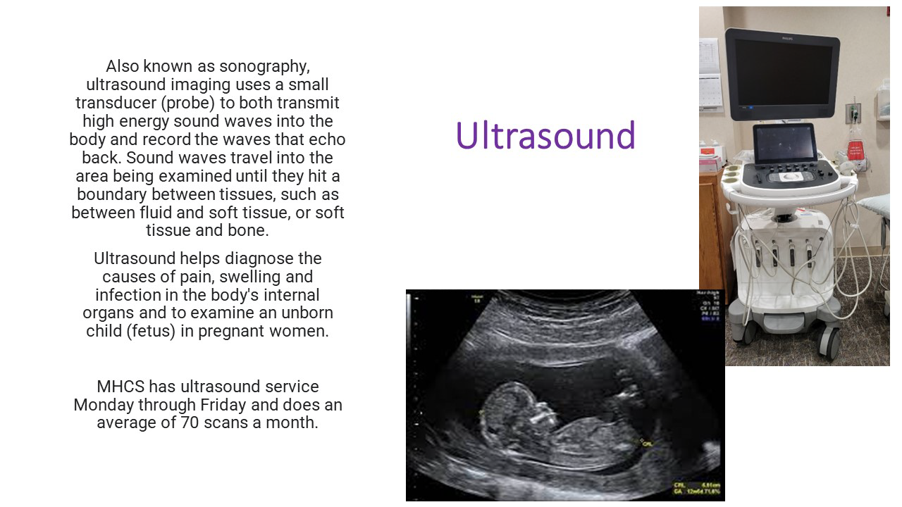 ultrasound explained